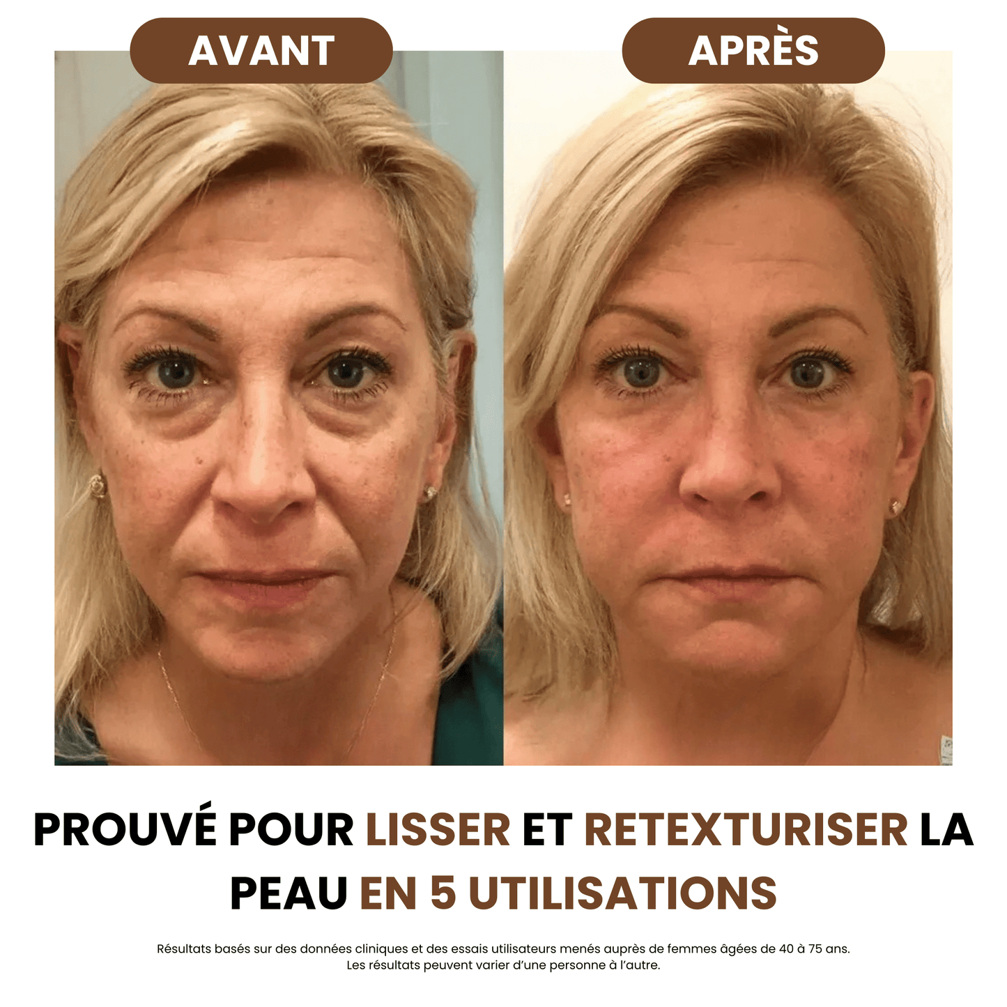 Brosse de Drainage Lymphatique