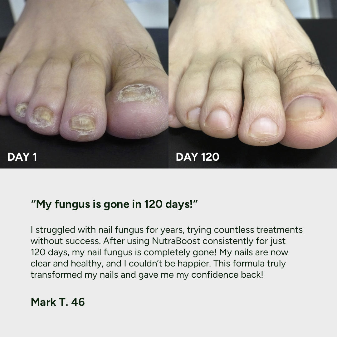 Anti-Fungal Odor Spray