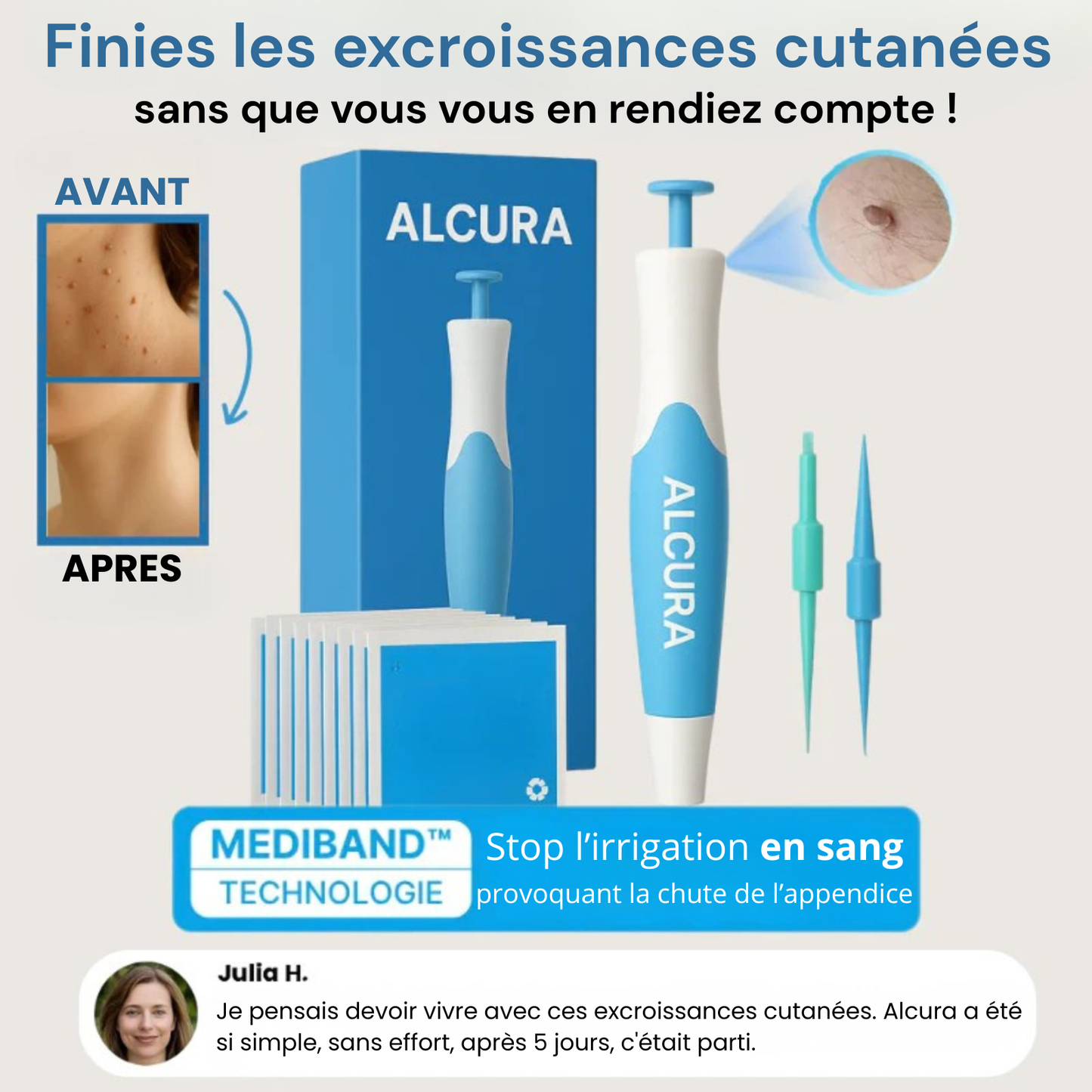 Alcura - Set complet