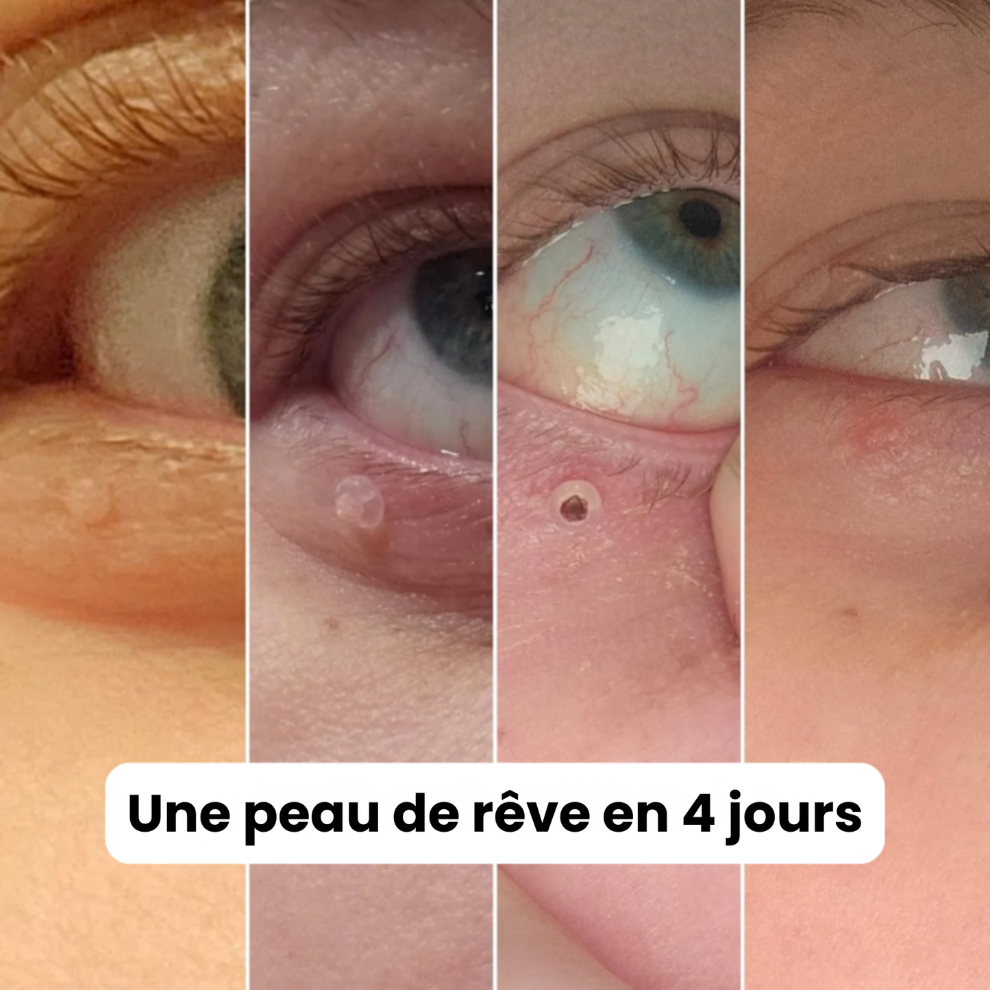 Alcura - Set complet