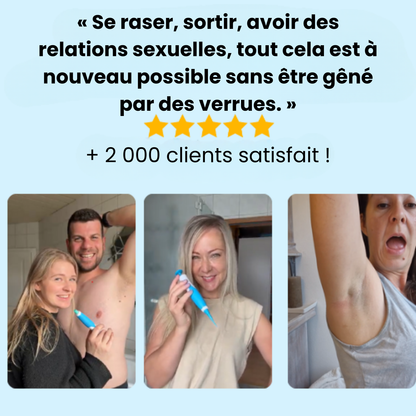 Alcura - Set complet