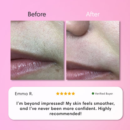 Instant Hair Removal Kit