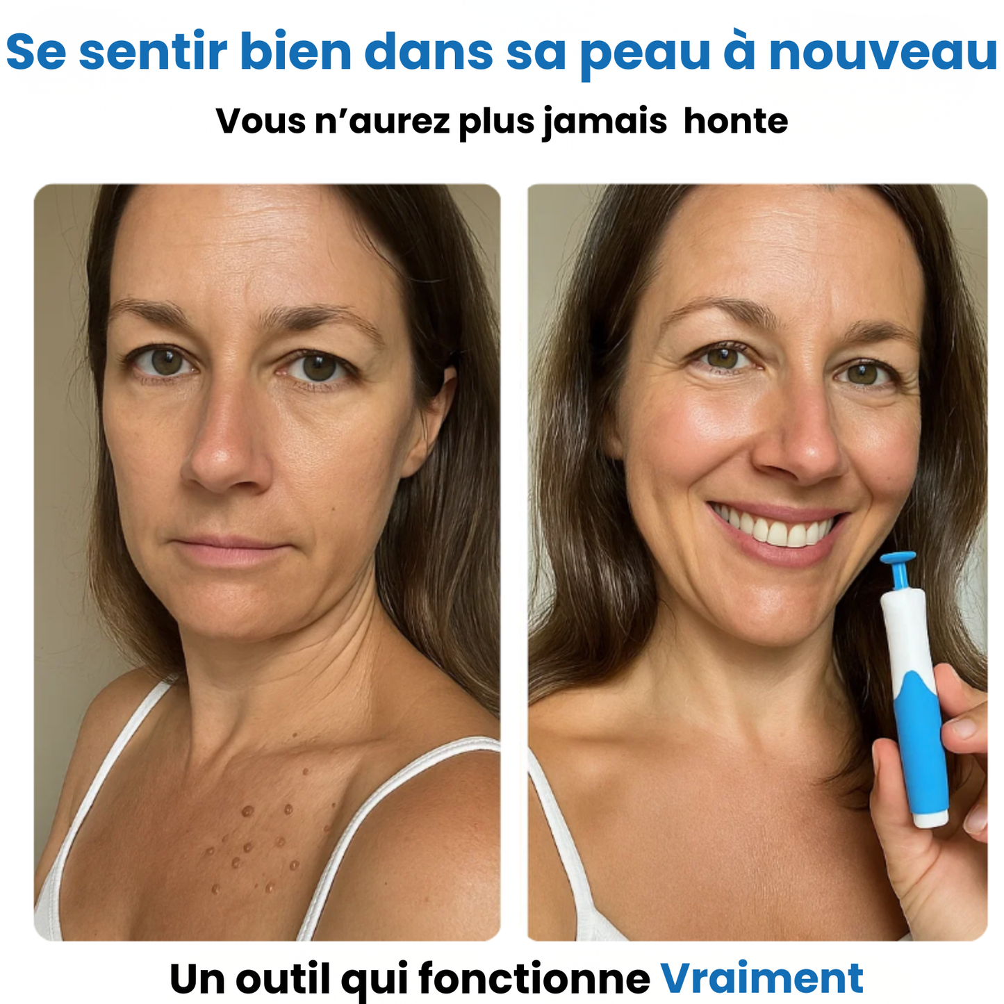 Alcura - Set complet