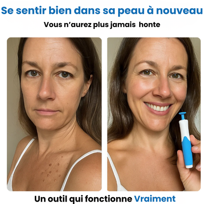 Alcura - Set complet