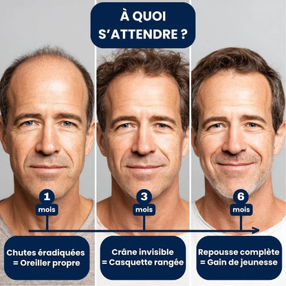 Collagix Micro Infusion - Régénération Capillaire