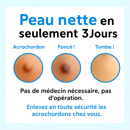 Alcura - Set complet