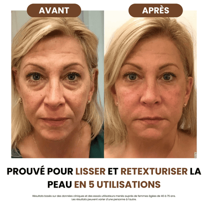 Brosse de Drainage Lymphatique