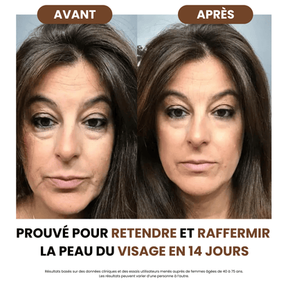 Brosse de Drainage Lymphatique