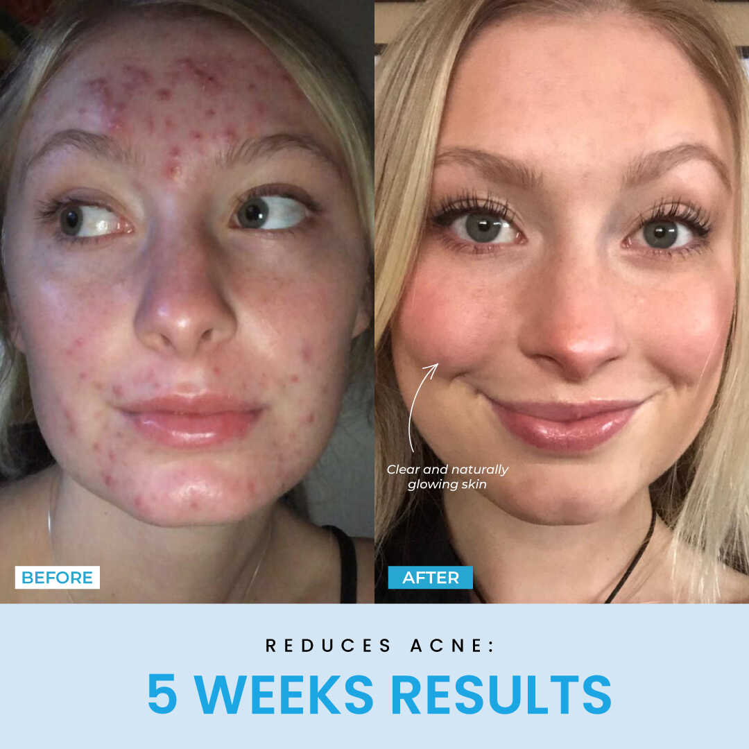 Liftlab Sculptor + Free Serum..