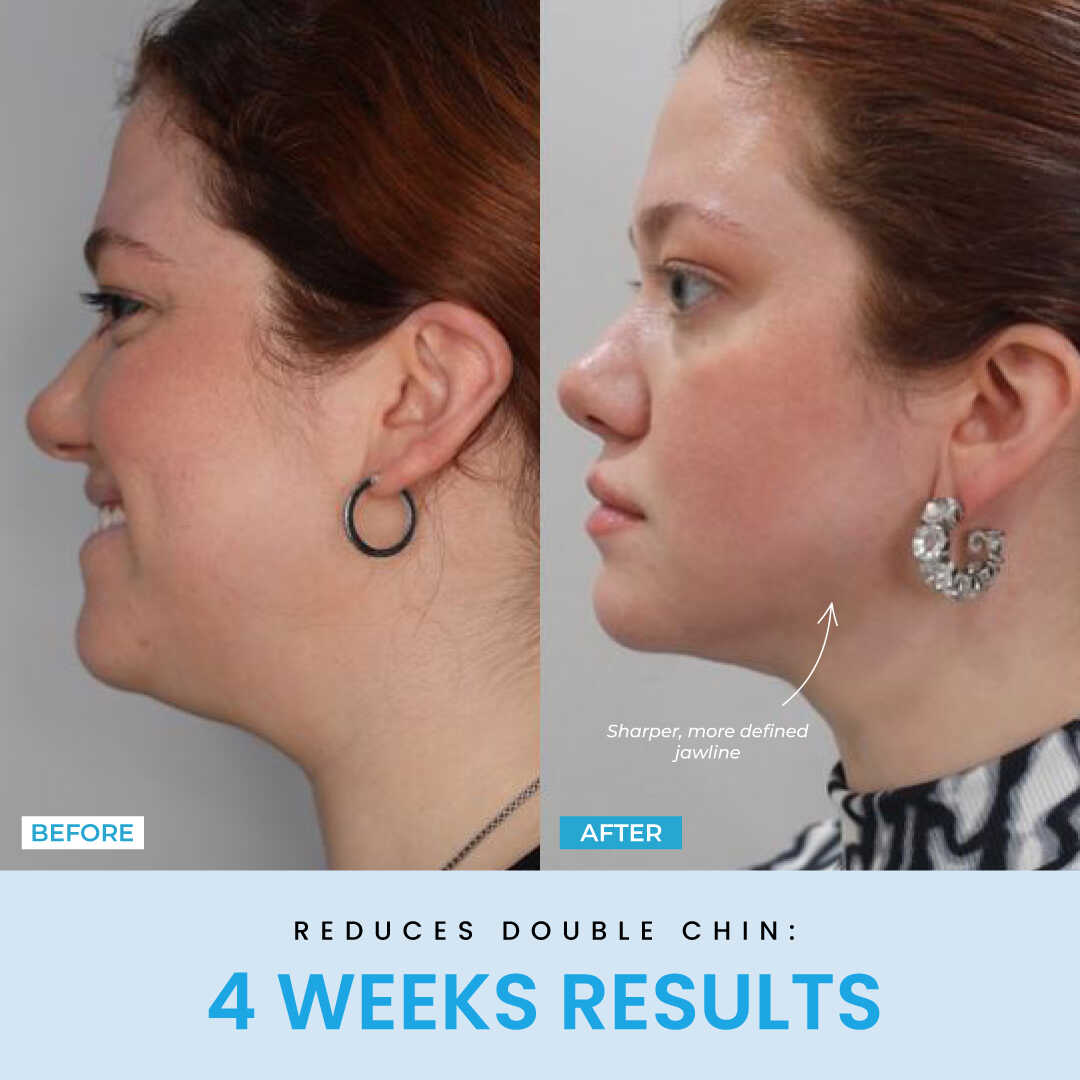 Liftlab Sculptor + Free Serum..