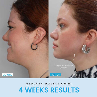 Liftlab Sculptor + Free Serum..