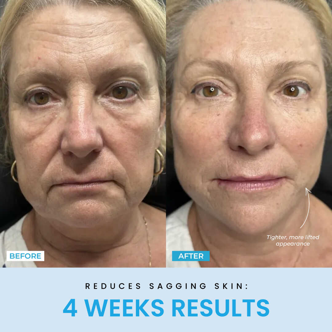 Liftlab Sculptor + Free Serum..