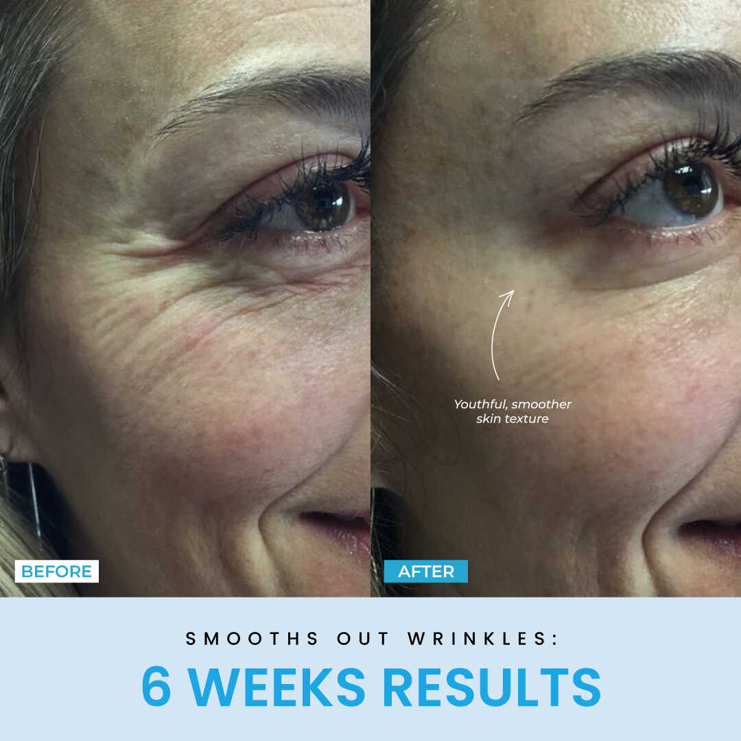 Liftlab Sculptor + Free Serum..