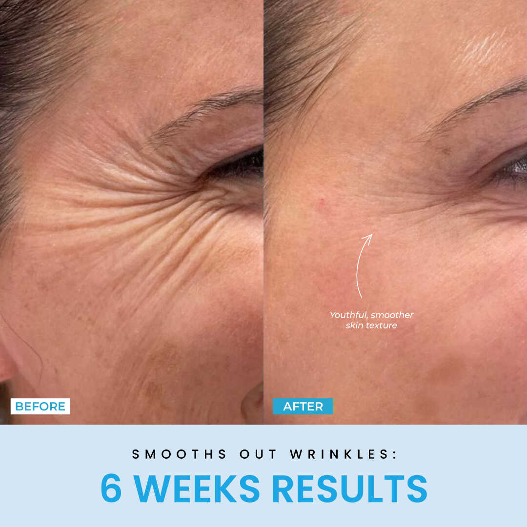 Liftlab Sculptor + Free Serum..