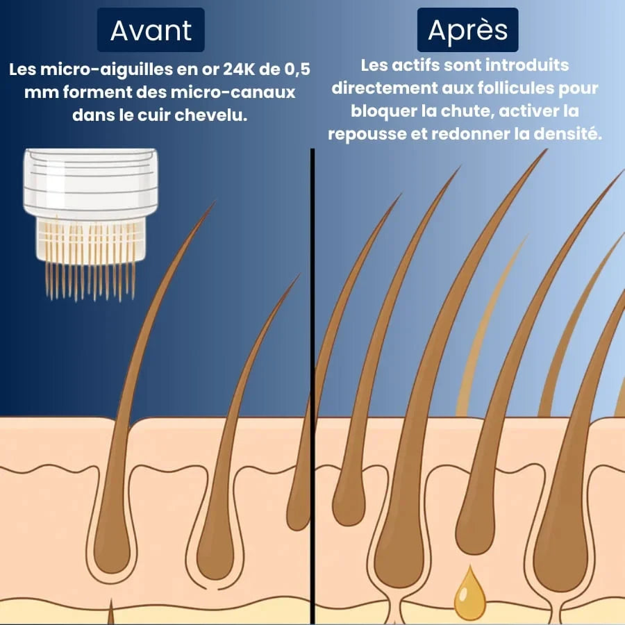 Collagix Micro Infusion - Régénération Capillaire