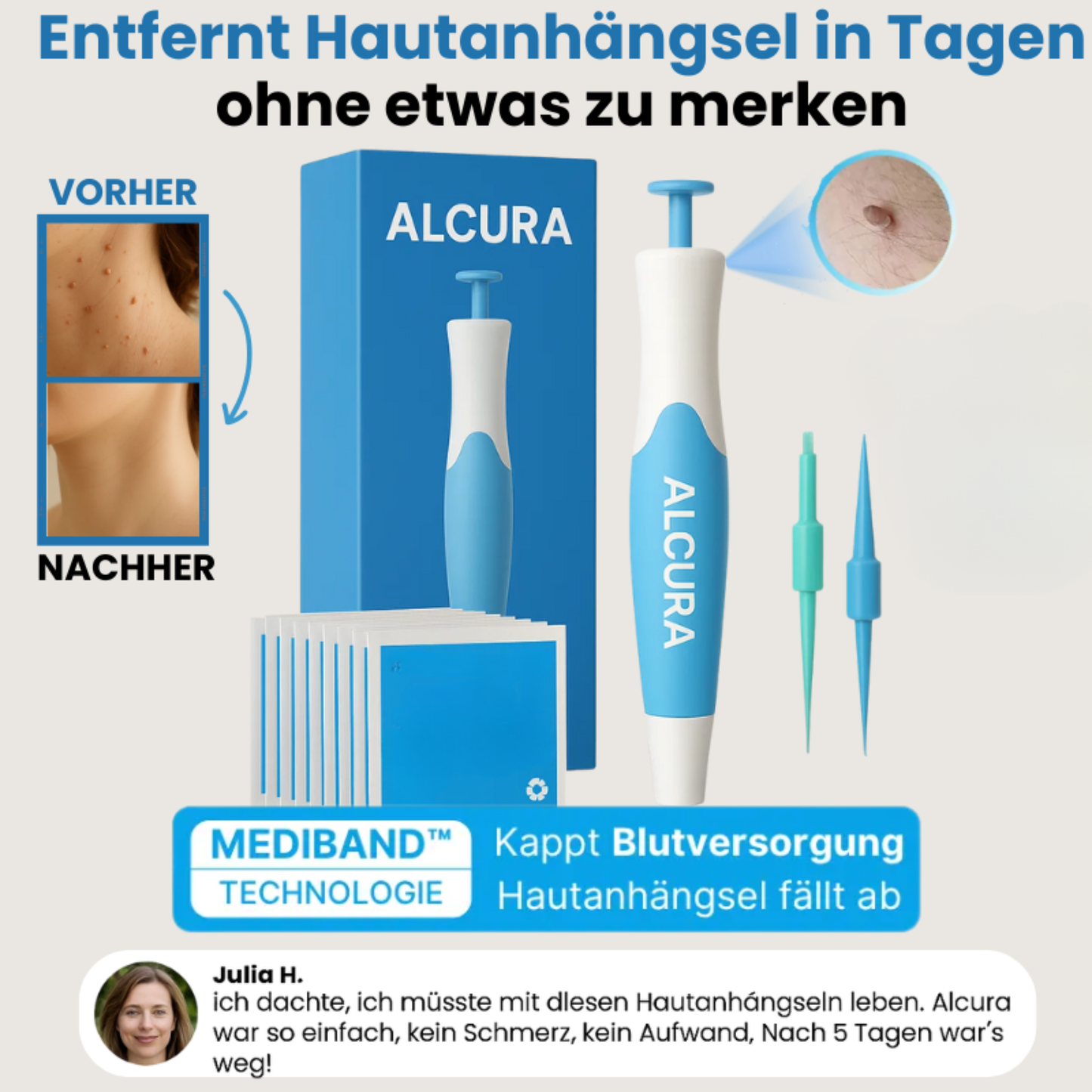 Alcura - Set complett